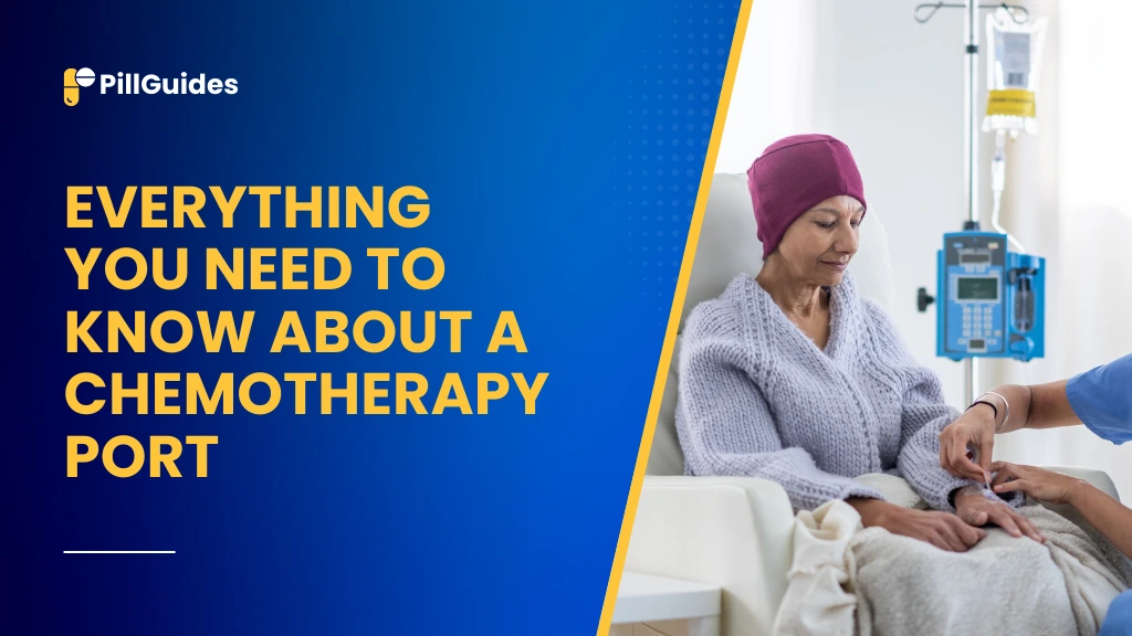 Chemotherapy Port